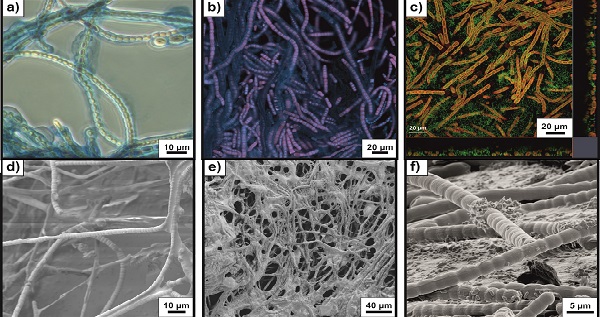 Different imaging techniques applied to biofilms consisting of Tolypotrix sp.
and P. taiwanensis (© Mahir Bozan / UFZ)